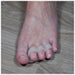 Aidapt Gel Toe Separator (Pair)